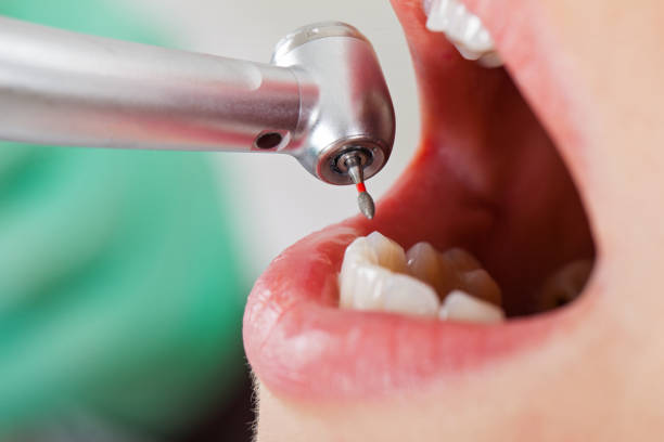Best After-Hours Dental Care in Friendship Heights Village, MD